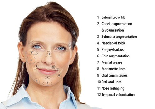 Dolgu Uygulama Bölgeleri Dolgu Uygulama Bölgeleri