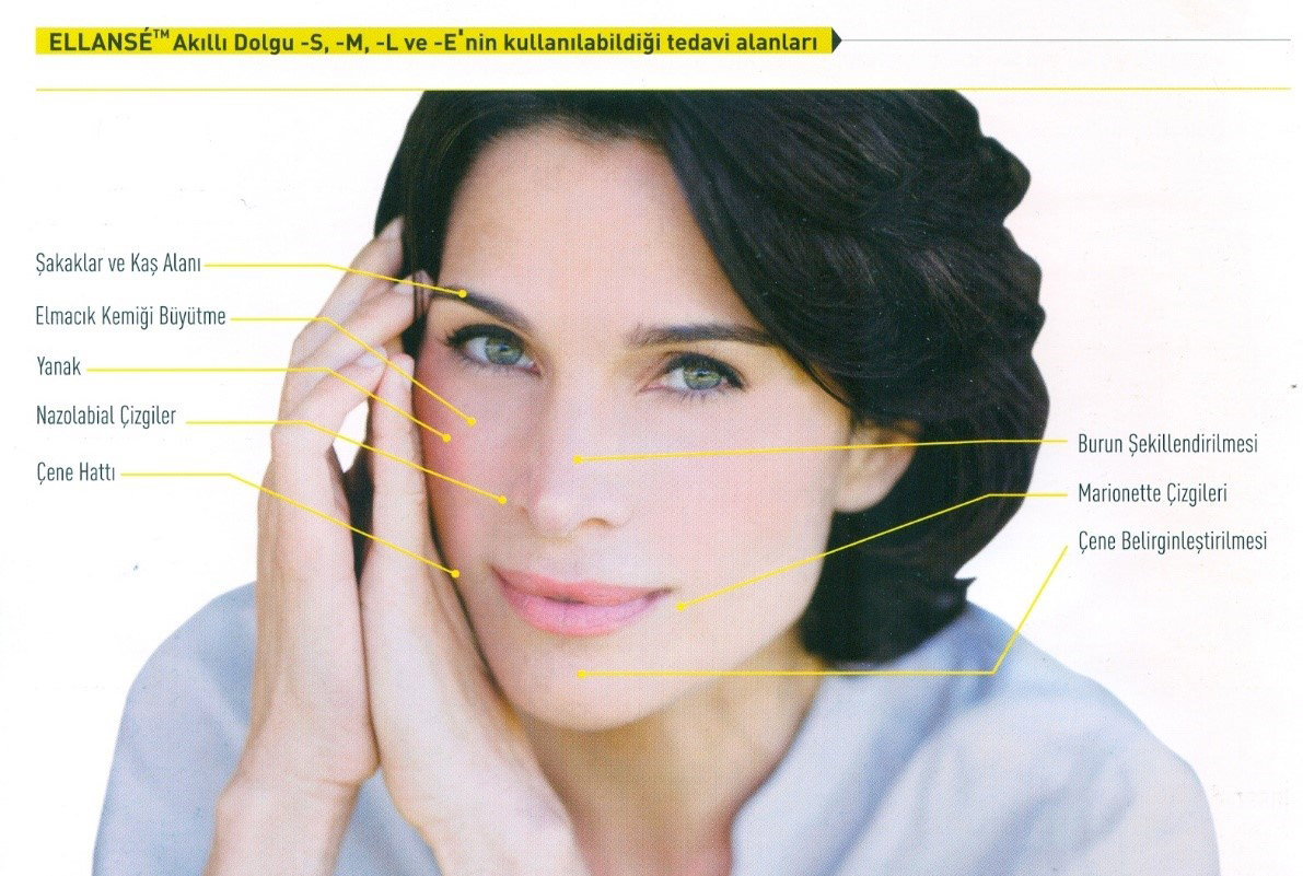 Ellanse'ni Kullanım Alanları Ellanse'ni Kullanım Alanları